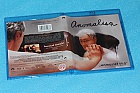 Anomalisa